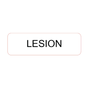 Lesion - 40 x 12, PAPER, Black print on White Label, 800 per roll