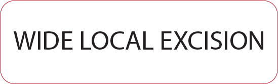 WIDE LOCAL EXCISION - 40 x 12, PAPER, Black print on White Label, 800 per roll