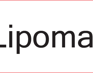 Lipoma - 40 x 12, PAPER, Black print on White Label, 800 per roll