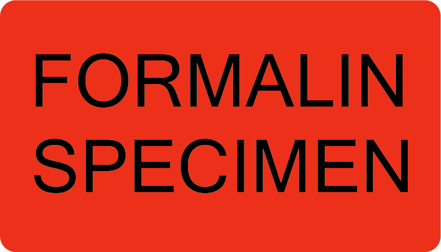 FORMALIN SPECIMEN - 70x40mm, Black print on fluoro red, 500 per roll