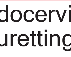 Endocervical Curettings - 40 x 12, PAPER, Black print on White Label, 800 per roll