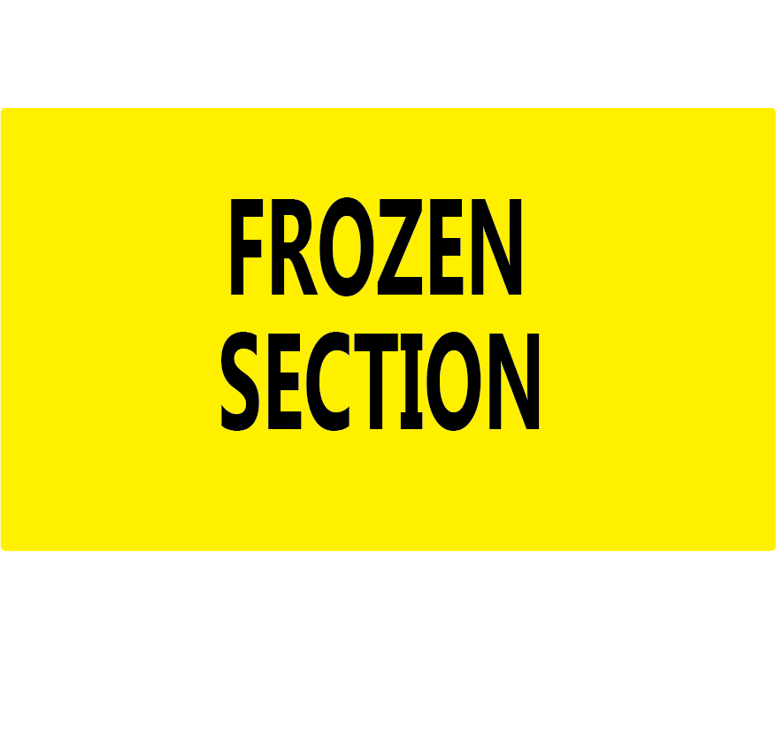 FROZEN SECTION - 70 x 40 Black on Fluoro Yellow 500 per roll