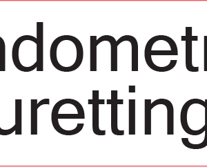 Endometrial Curettings - 40 x 12, PAPER, Black print on White Label, 800 per roll