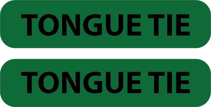 TONGUE TIE , DARK GREEN LABELS 35 x 8 mm 2 UP 1000 PER ROLL